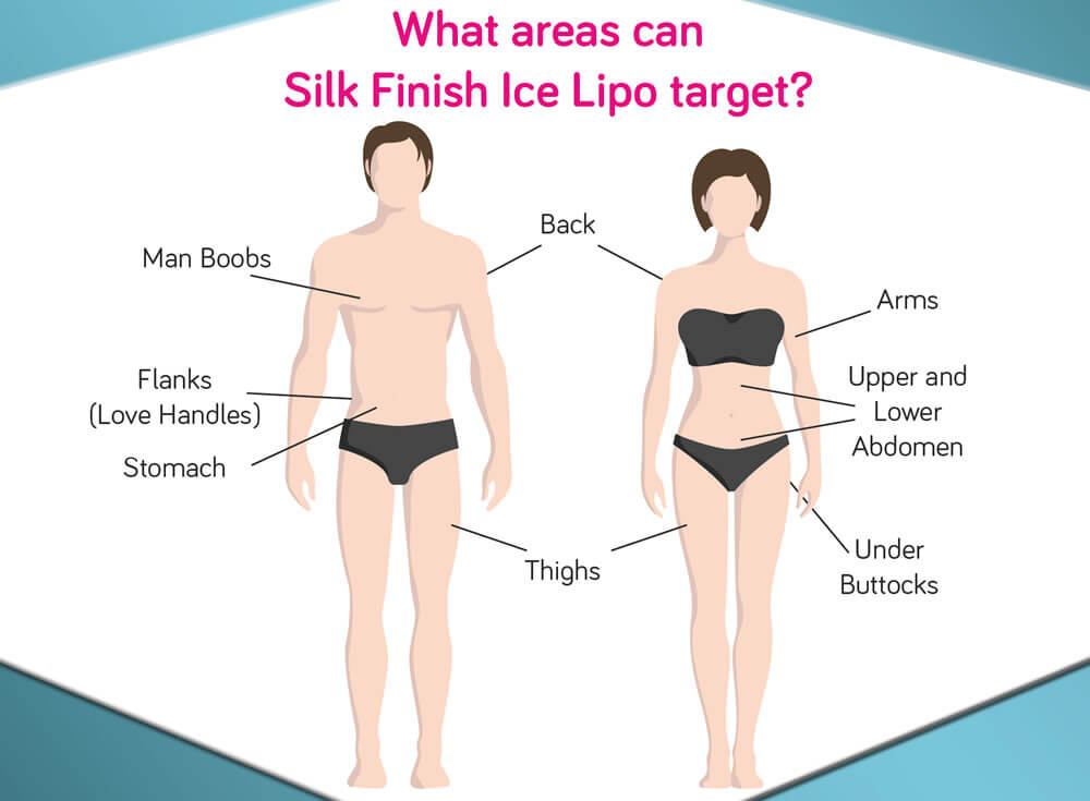  Treatable Areas In Men And Women For Ice Lipo Treatments Provided By Silk Finish Beauty Salon In Marlborough